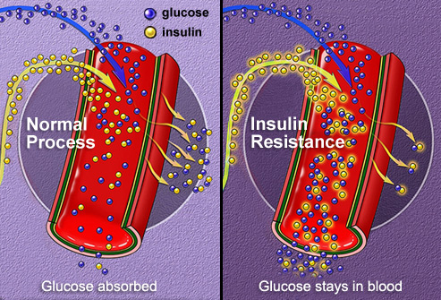 phototake_rm_illustration_of_insulin_absorption.jpg