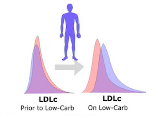 Untangling LDL-C Elevation in Lean Mass Hyper Responders (LMHR) on a Ketogenic Diet