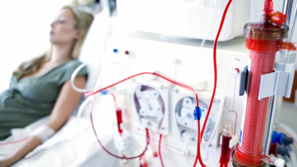 woman having dialysis treatment